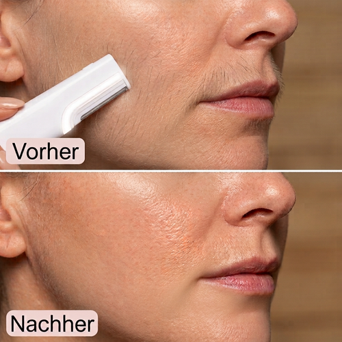 Dermaplaning-Rasierer