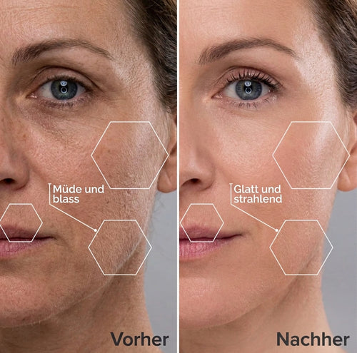 Dermaplaning-Rasierer